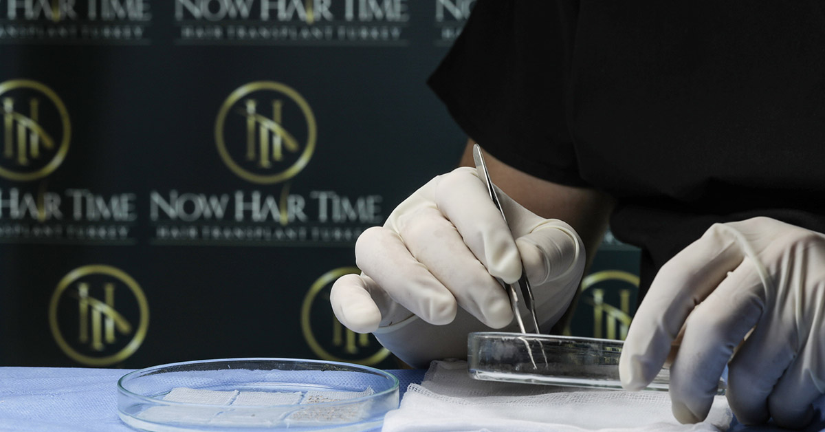 Новое поколение трансплантации волос